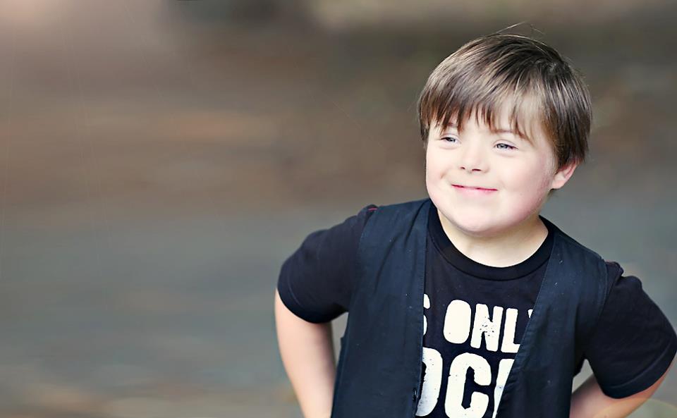 DOWN SENDROMU TANIMI VE SEBEPLERİ